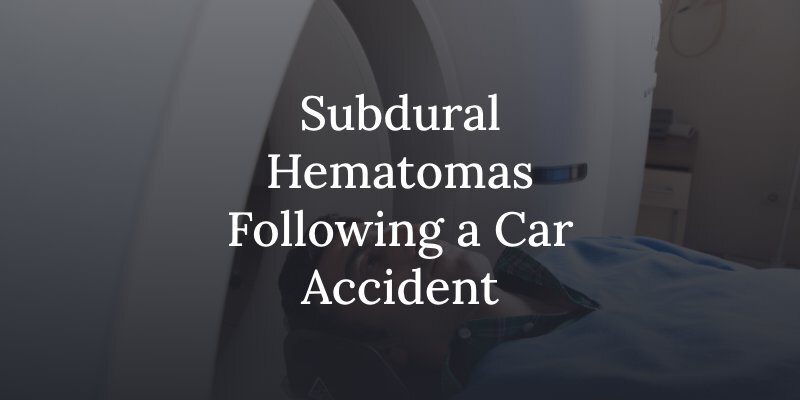Subdural Hematomas Following a Car Accident